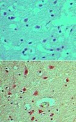 Immunohistochemistry-Paraffin: SHIP2/INPPL1 [p Tyr497] Antibody [NBP2-24461] - Analysis of phosphorylated SHIP2 in formalin-fixed, paraffin-embedded human brain tissue using an isotype control (top) and this antibody (bottom) at 5 ug/ml.